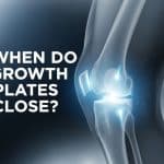 When Do Growth Plates Close? Age, Signs, and What It Means for Height